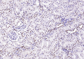 CENPA Rabbit Polyclonal Antibody