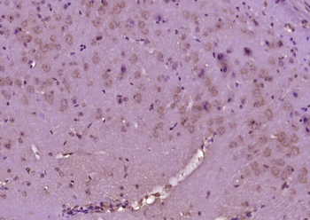 Phospho-ERBB3 (Tyr1197) Rabbit Polyclonal Antibody