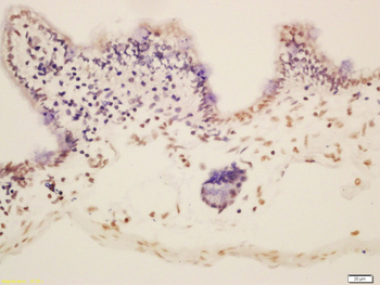 Phospho-c-Fos (Thr325) Rabbit Polyclonal Antibody