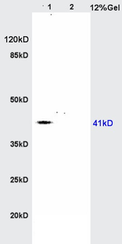 AGPAT4 Rabbit Polyclonal Antibody