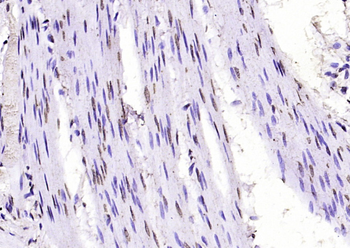Cofilin Rabbit Polyclonal Antibody