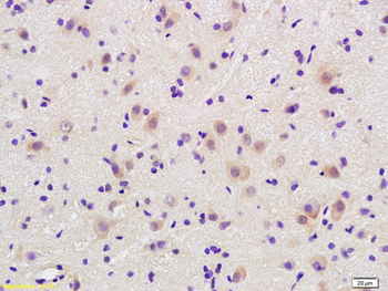 Cofilin Rabbit Polyclonal Antibody