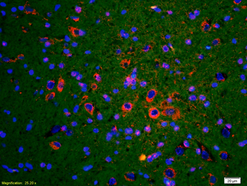 Phospho-Cardiac Troponin I (Ser23 + Ser24) Rabbit Polyclonal Antibody