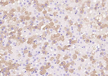 CYP11A1 Rabbit Polyclonal Antibody