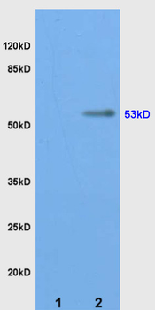CYP11A1 Rabbit Polyclonal Antibody