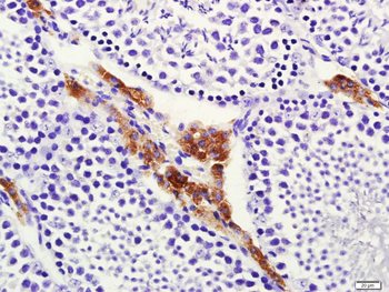 Cytochrome P450 17A1 Rabbit Polyclonal Antibody