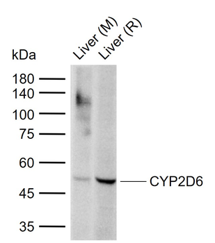 CYP2D6 Rabbit Polyclonal Antibody