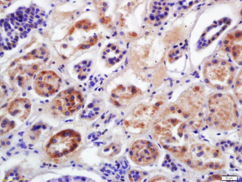 CYP2D6 Rabbit Polyclonal Antibody
