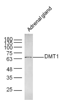 DMT1 Rabbit Polyclonal Antibody
