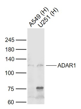 ADAR1 Rabbit Polyclonal Antibody