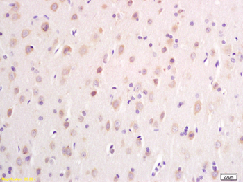 DTNB Rabbit Polyclonal Antibody