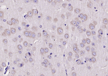 EPO Rabbit Polyclonal Antibody