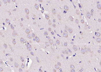 EPO Rabbit Polyclonal Antibody