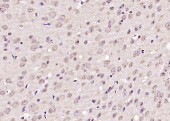 Phospho-PYK2 (Tyr402) Rabbit Polyclonal Antibody
