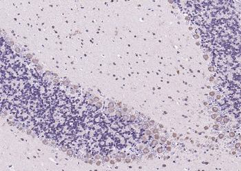Phospho-PYK2 (Tyr402) Rabbit Polyclonal Antibody