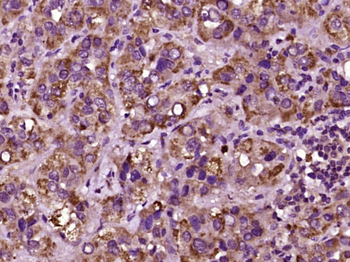CRK Rabbit Polyclonal Antibody