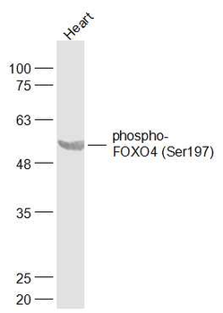 Phospho-FOXO4 (Ser197) Rabbit Polyclonal Antibody