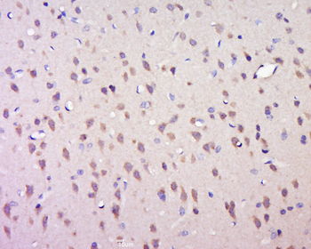 Phospho-FOXO4 (Ser262) Rabbit Polyclonal Antibody