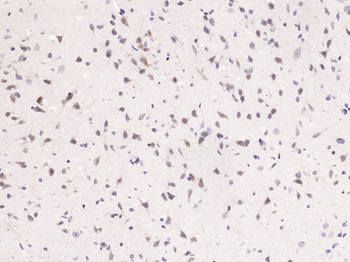 GAB2 Rabbit Polyclonal Antibody