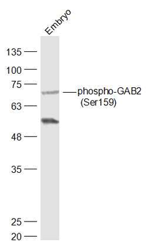 Phospho-GAB2 (Ser159) Rabbit Polyclonal Antibody