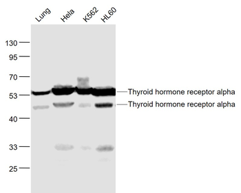 Thyroid hormone receptor alpha Rabbit Polyclonal Antibody