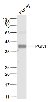 PGK1 Rabbit Polyclonal Antibody