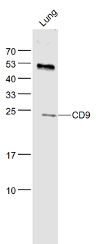CD9 Rabbit Polyclonal Antibody