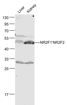 NR2F1/NR2F2 Rabbit Polyclonal Antibody