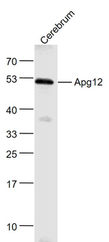 ATG12 Rabbit Polyclonal Antibody