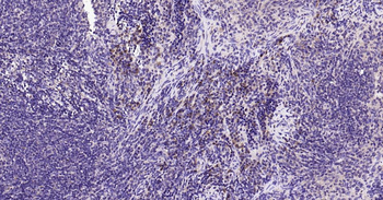 Bax Recombinant Rabbit Monoclonal Antibody