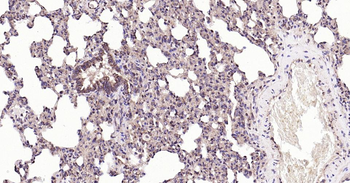 Bax Recombinant Rabbit Monoclonal Antibody