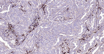 Bax Recombinant Rabbit Monoclonal Antibody