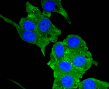 Neuropilin-1 Recombinant Rabbit Monoclonal Antibody
