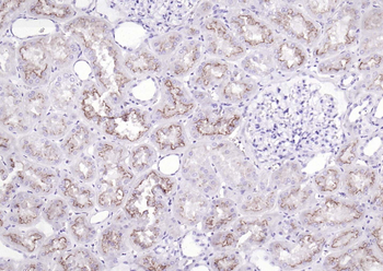 Neuropilin-1 Recombinant Rabbit Monoclonal Antibody