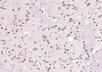 RNF105 Rabbit Polyclonal Antibody