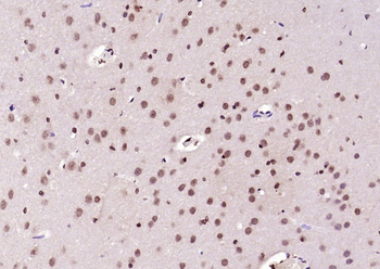 RNF105 Rabbit Polyclonal Antibody