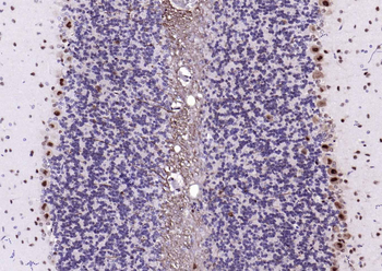 PSMA1 Recombinant Rabbit Monoclonal Antibody
