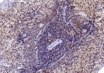 PSMA1 Recombinant Rabbit Monoclonal Antibody