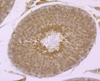 PSMA1 Recombinant Rabbit Monoclonal Antibody