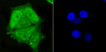 PSMA1 Recombinant Rabbit Monoclonal Antibody