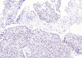 PSMA1 Recombinant Rabbit Monoclonal Antibody
