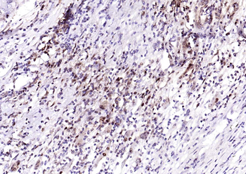 PSMA1 Recombinant Rabbit Monoclonal Antibody