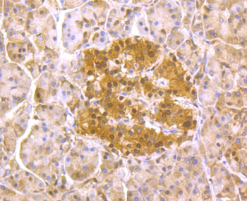 PSMA1 Recombinant Rabbit Monoclonal Antibody