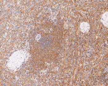 IKK gamma Recombinant Rabbit Monoclonal Antibody