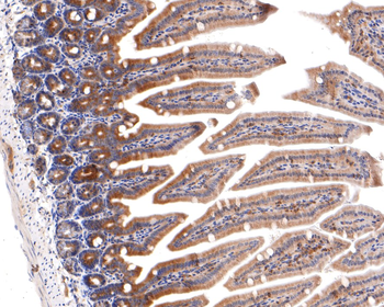 IKK gamma Recombinant Rabbit Monoclonal Antibody