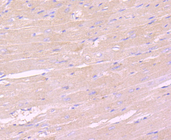 IKK gamma Recombinant Rabbit Monoclonal Antibody