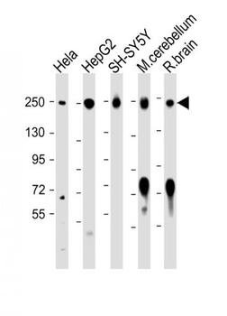 CD171/L1CAM Rabbit Polyclonal Antibody