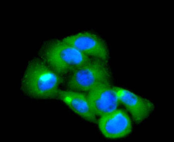 CD14 Recombinant Rabbit Monoclonal Antibody