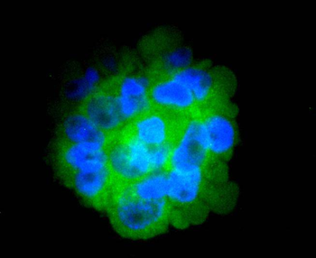 CD14 Recombinant Rabbit Monoclonal Antibody