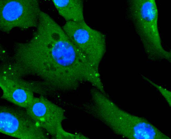 CD14 Recombinant Rabbit Monoclonal Antibody